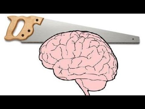 Split brain. Расщепление мозга. Синдром расщепленного мозга.