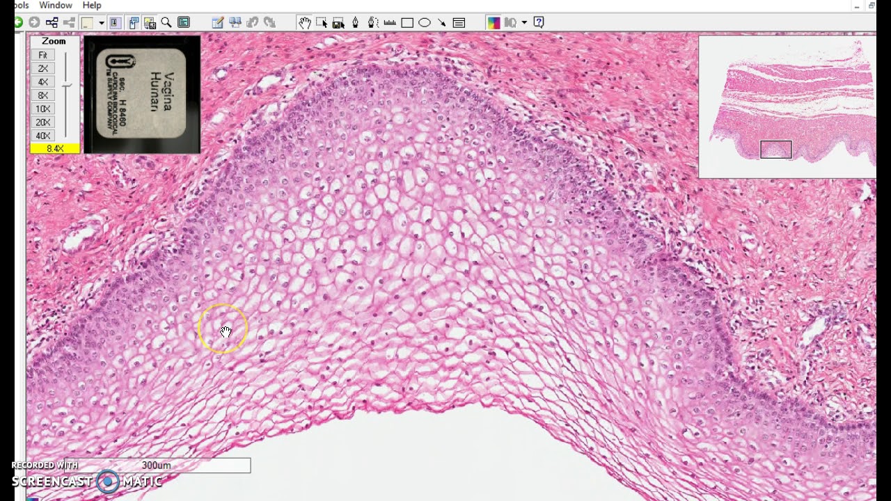 nonkeratinized stratified squamous epithelium YouTube