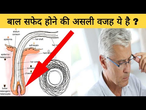 वीडियो: क्या साँचा कभी सफ़ेद होता है?