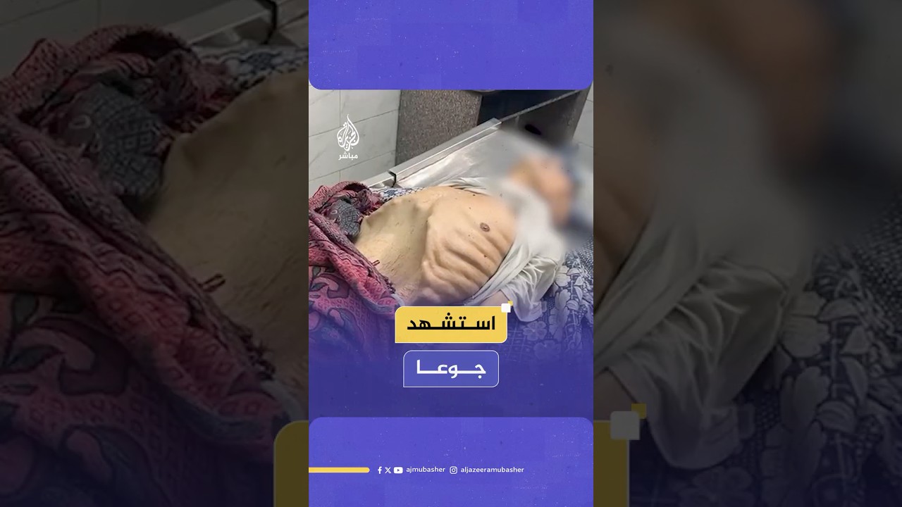 استـ ـشـهـاد المسن الفلسطيني خليل أبو ركبة في مجمع الشفاء الطبي بسبب استمرار التجويع في قطاع غزة