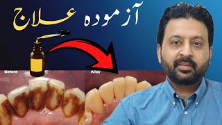 SENIORS: The #1 Gum Bacteria Killer Dentists Never Talk About — Just 1 Drop! 🦷