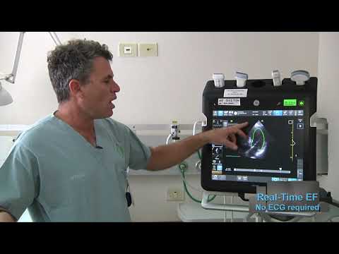 Assessing patients using Venue™ Family point of care ultrasound Auto Tools | GE Healthcare