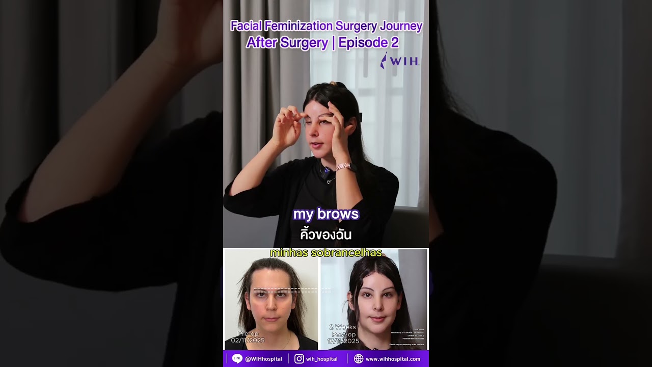 Mia from Portugal 🇵🇹 for Facial Feminization Surgery with Dr. Chettasak