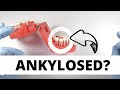 How To Extract Ankylosed Teeth | OnlineExodontia.com