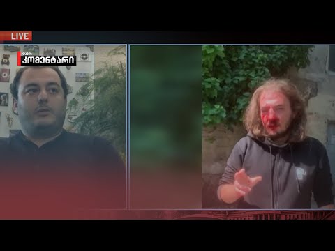 „მისი მდგომარეობა დამაკმაყოფილებელია“, — ლევან ბერძენიშვილი