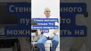 Стенка желчного пузыря: Что можно увидеть на УЗИ #узи #ultrasound #доктор #желчныйпузырь
