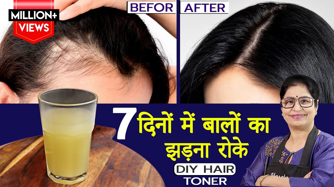                  Homemade Hair Growth Toner