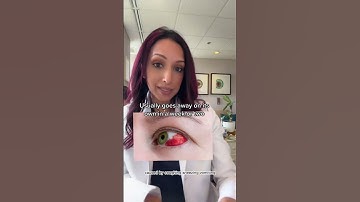 Did You Wake Up With Blood In Your Eye? | Eye Doctor Explains #shorts #health #eyes