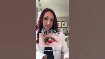 Did You Wake Up With Blood In Your Eye Eye Doctor Explains Shorts Health Eyes 
