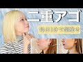 【意外と勘違いかも?】あなたの二重顎本当に太ったからですか?痩せたらなくなりますか?