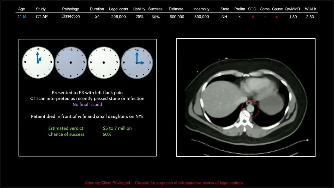 137 Years of Medical Malpractice Part 4 Free Radiology CME YouTube