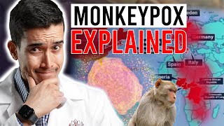 Monkeypox Outbreak 2022 | What You Need to Know