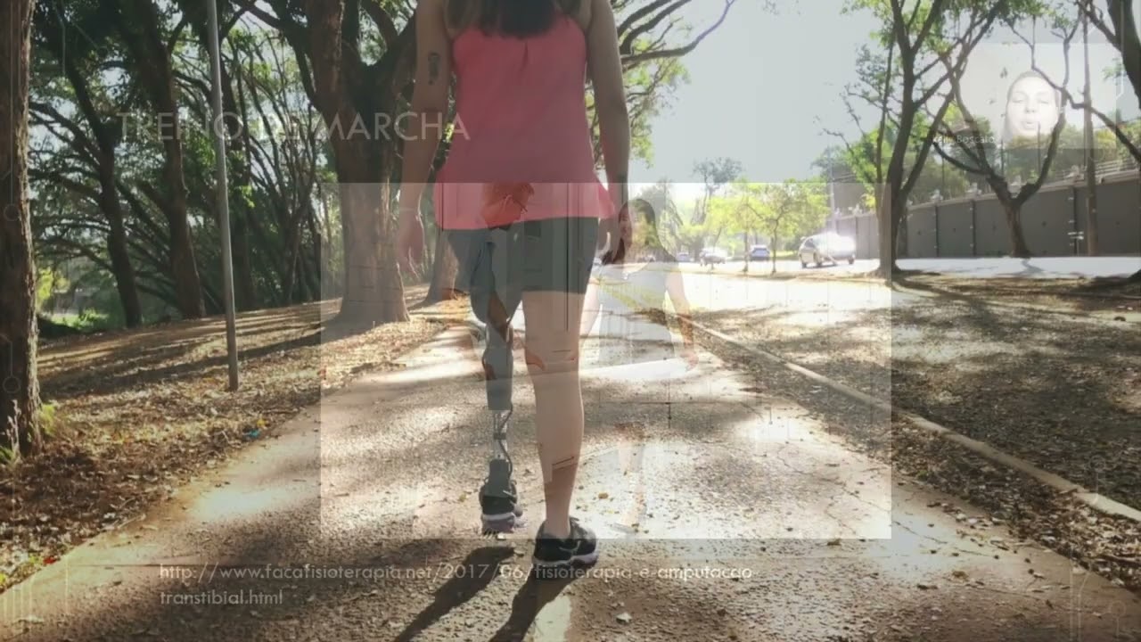 Reabilitação de Pacientes Amputados - Treino de Marcha