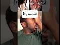 أنفك مسدود 