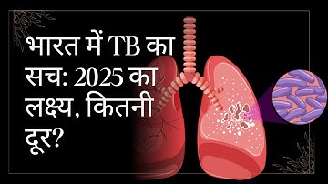 भारत में TB का सच: 2025 का लक्ष्य, कितनी दूर?