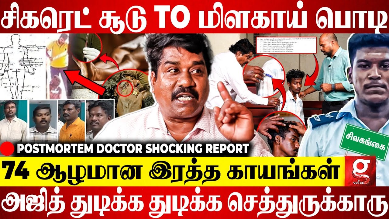 உச்சந்தலை முதல் உள்ளங்கால் வரை😱Ajith-க்கு நடந்த சித்திரவதை😮Postmortem Report-ல் பகீர் | Dr.Dekkal