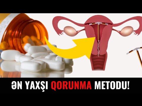 Video: Hamilə qadınlarda erkən preeklampsi: əlamətlər, simptomlar və müalicə