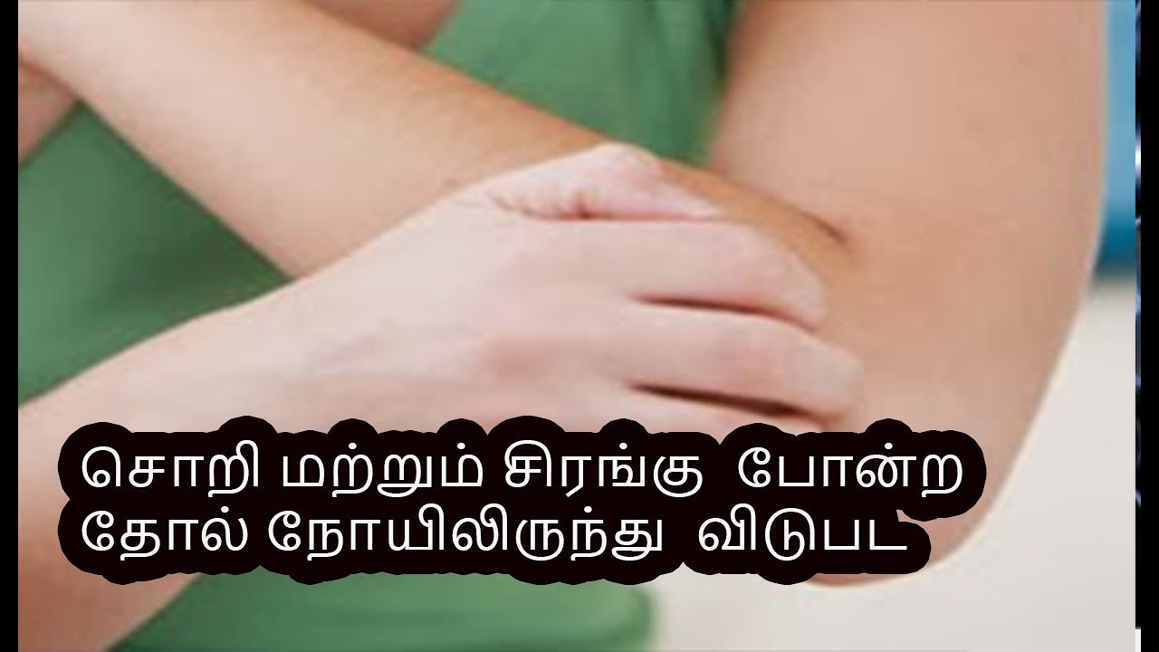 சொறி மற்றும் சிரங்கு குணமாக | Get rid of skin diseases like rash and scabies - YouTube