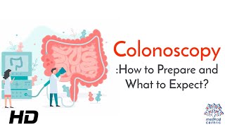 Colonoscopy: The Lifesaving Procedure You Shouldn&#39;t Ignore