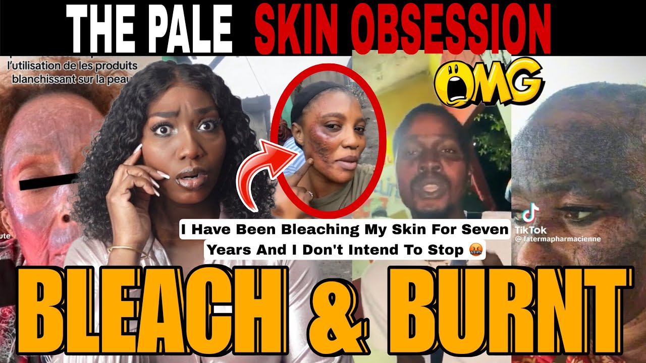glutathione makes skin lighter Glutathione Injections For Skin Whitening: A Complete Guide main image 0
