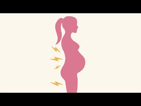 Videó: Okozhat-e hátfájást a korai terhesség?