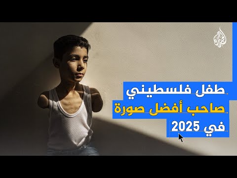 يوم في حياة الطفل محمود عجور مبتور اليدين الذي حازت صورته أفضل جائزة للعام 2025