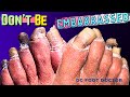Don't Be Embarrassed: Toenails Trimmed After Many Years of Being Embarrassed About Her Feet
