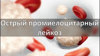 Острый промиелоцитарный лейкоз