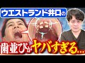 ウエストランド井口の特殊な歯並びを歯医者さんが勝手に診察【歯列矯正】 #ウエストランド井口 #歯並び #歯並び矯正