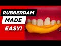 Class IV Pt 3: The Rubber Dam Hack You Need!