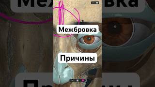 Межбровная складка
