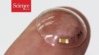 These smart contacts can monitor the glucose in tears