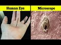 Human Body Under Electron Microscope | Things You Can See Only Under Microscope