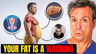 Patient Trap: Your FAT Isn’t RANDOM