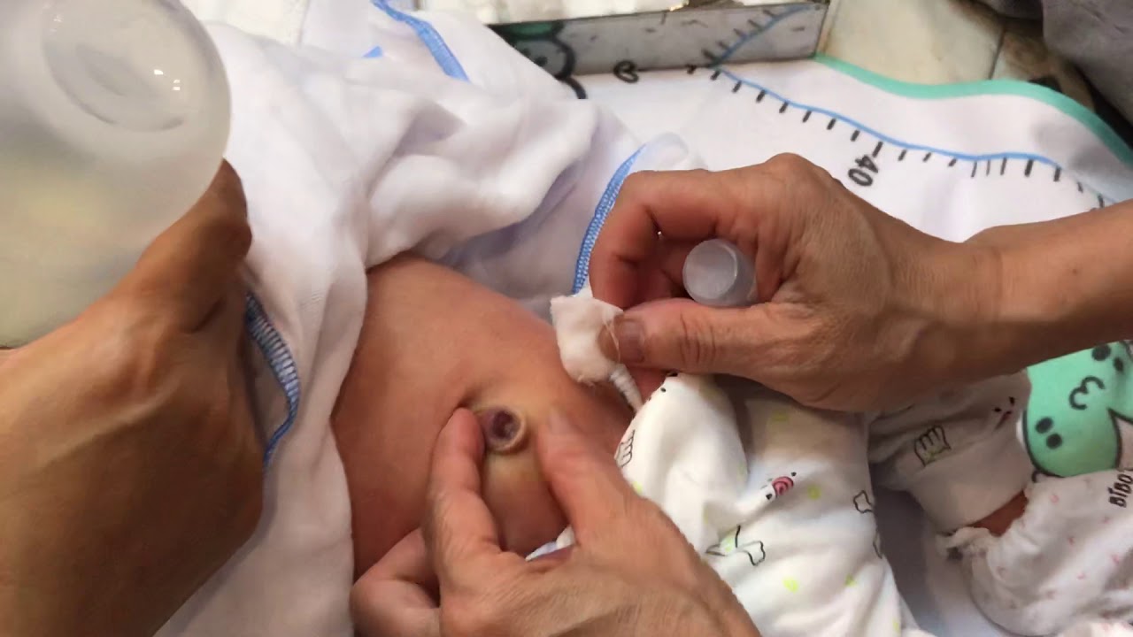 Cách vệ sinh rốn bé khi mới rụng - điều các Mom cần biết ạ- Bé Vừng 7 ngày tuổi ạ