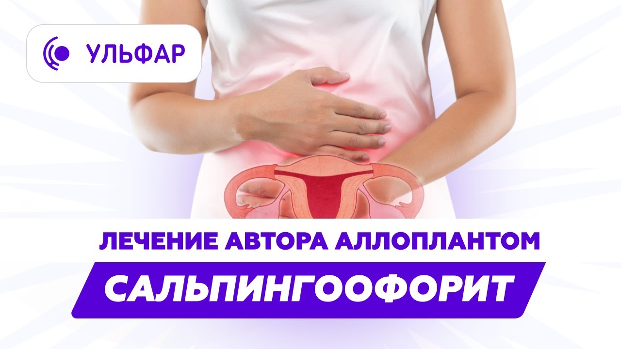 Лечение сальпингоофорита Аллоплантом в Уфе - YouTube