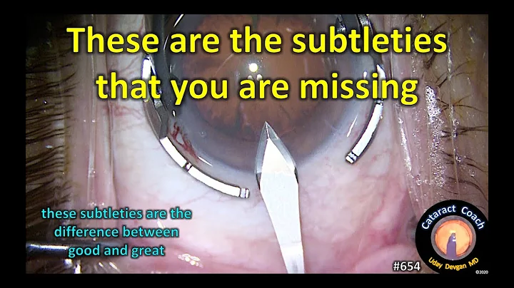 Subtleties to take your cataract surgery from good...