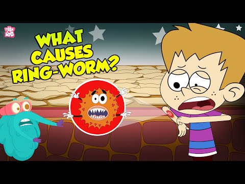Ringworms को कारण के हो? | छालाको संक्रमण | डा बिनोक्स शो | Peekaboo Kidz
