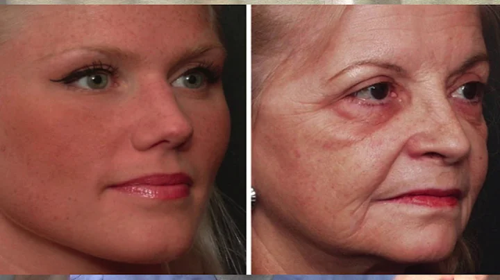 Quick Review on Facial Aging