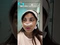 😍😍 #rhinoplasty #facialcontouringsurgery #facecontour #doubleeyelid  #plasticsurgerykorea