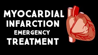 Myocardial Infarction (MI,Heart Attack) Treatment in Emergency | Step wise STEMI Management USMLE