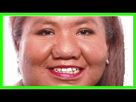 Oklahoma Woman Dies After Being Mauled by Pack of Dachshund Dogs - YouTube