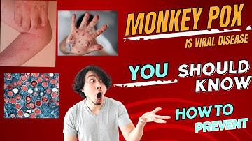 Monkeypox Outbreak 2024 Symptoms, Prevention, and Viral Threat!