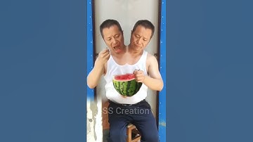 Faded Song | Disable Conjoined Man#disabled#disabledlife#shorts