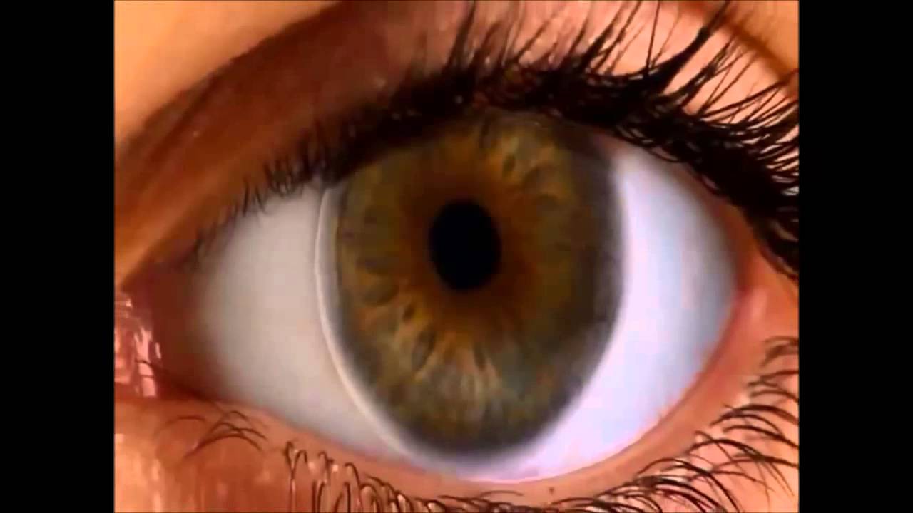 air optix for astigmatism