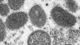 Health officials need to balance warning populations about monkeypox without stigmatizing them