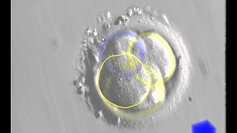 Demonstration Video for "Artificial Defocus for Displaying Markers in Microscopy Z-Stacks"