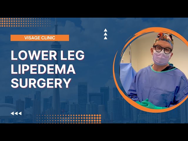 Lipedema Surgery | Visage Clinic Toronto