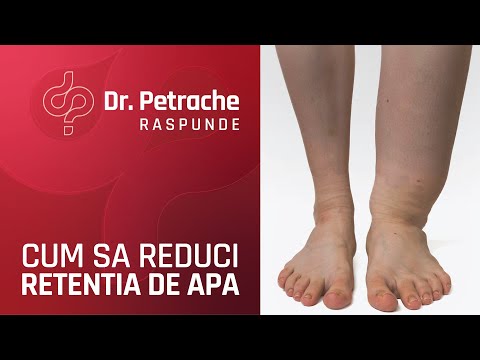 MODURI SIMPLE PRIN CARE POTI REDUCE RETENTIA DE APA