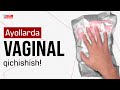 Vaginada qichishish sovuqning alomatidir. Vaginada qichishish sovuqning alomatidir.